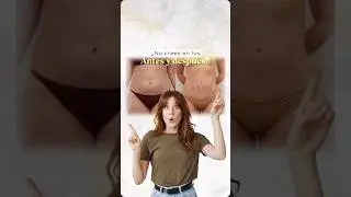 Reduce tu cintura con Aqualipo solo en Paloma Clinic Spa #reducirmedidas
