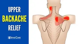 Как мгновенно устранить боль в верхней части спины