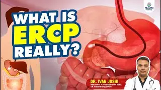 What Is ERCP? Procedure, Diagnosis & Treatment for Bile Duct Stones | Dr.&nbsp;Ivan&nbsp;Joshi
