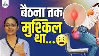 बैठने-खड़े होने में हमेशा दर्द? Pilonidal Sinus से मुक्ति की मेरी कहानी | Pilonidal Sinus Surgery