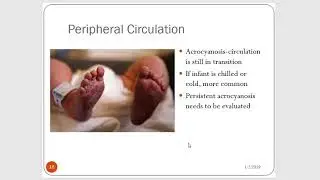 Adaptations of the Newborn part 1
