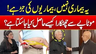 How to Lose Weight & Get Rid Of Obesity? | Health Tips | Must Watch | City 21