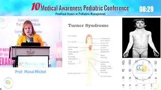 Clinical Approach To Short Stature highlighting the Genetic Causes Prof Manal Michael