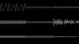 Sonic 2 (Beta) - Casino Night Zone (oscilloscope view)