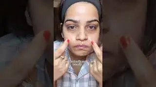 Try this hack to Reduce smile lines ✨👍🏻