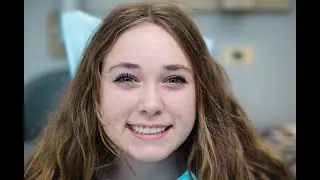 Blue Water Dental | 90 minutes of Zoom Whitening in 90 seconds