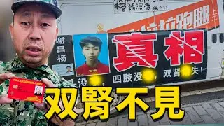 一個不被爆光的中共「活取零件」真相！