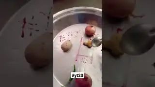 #yt20,#yt2022