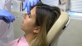Chemical Rhinoplasty Procedure