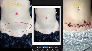 Postpartum Scar Cover-Up Tattoo &ndash; Confidence Reborn