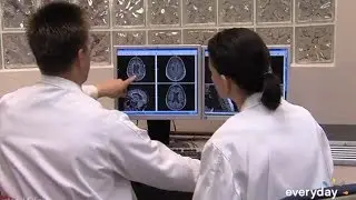 Statins May Slow Progressive MS
