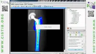 Bone Mineral Density (BMD) map template
