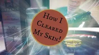How I Cleared My Skin