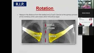 How to read chest xray GMC Rajnandgaon confrance