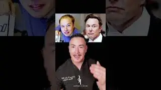 Elon Musk Hair Transplant Analysis