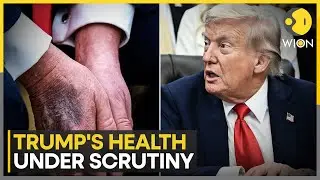Is US President Trump Suffering From Alzheimer's? | WION News
