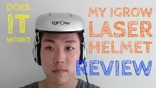 I Got An iGrow Laser Helmet!