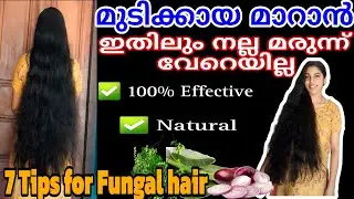 മുടികായ എങ്ങനെ മാറ്റാം/Mudikaya treatment at home/How to remove hair tangles naturaly/Get thick hair