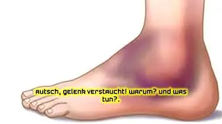 Autsch, Gelenk verstaucht! Warum? Und was tun?