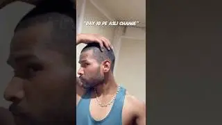 Day6&ndash;beard & hair nahi,mindset grow ho raha haiStruggle makesyoustronger #Transformation#BeardGrowth