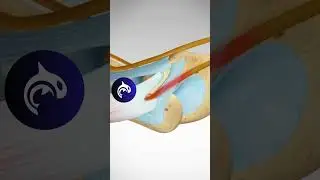 When Your &ldquo;Funny Bone&rdquo; Isn&rsquo;t Funny | Cubital Tunnel Syndrome in 3D