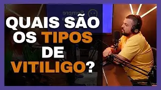 QUAIS S&Atilde;O OS TIPOS DE VITILIGO?