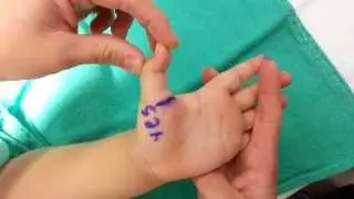 pediatric trigger finger Release
