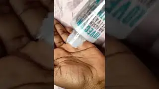 Skincare Product Recommendation!!! with Rovectin skin essentials Activating treatment lotion.