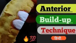 Anterior Build Up Techniques| Ceramic porcelain|| Anatomy| Dental videos| Posterior |Laboratory| art