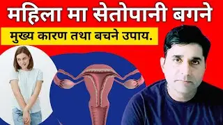 Seto pani bagnu ko karan//Seto pani kina bagxa//