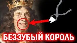 Why did they pull ALL of Louis XIV's teeth? You'll be amazed!