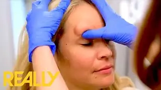 Загадочная 40-летняя шишка Ванессы &mdash; не то, что она думала | Bad Skin Clinic