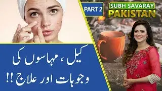 How to Get Rid of Acne (Pimples) | Subh Savaray Pakistan (Part 2) | 26 November 2019