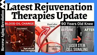 LATEST Rejuvenation Applications Update: Stem Cell, Exosomes, Light & More!