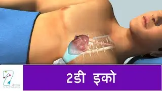 2 डी इको | 2D Echo | Hindi