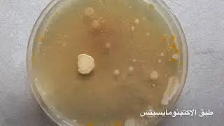 تقدير البكتريا والفطريات في التربة بطريقة التخافيف والعد بالاطباق