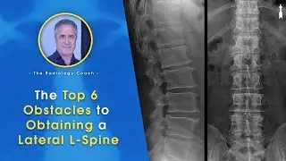 The Top 6 OBSTACLES to Obtaining a LATERAL L-SPINE