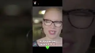 Dating Challenges: My Experience with Albinism - Shades of Her