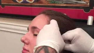 Daith procedure video by Luis Garcia (me)