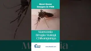 Most Important images for PSM