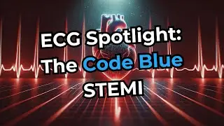 ECG Spotlight: The Code Blue STEMI