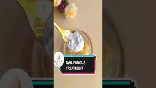 How To Treatment Nail Fungus at home with garlic #shorts #nailfungustreatment #nailpolish