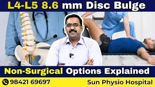 Sciatica Cause & Relief Tips | Sacralisation of Spine Explained | Sun Physio Hospital .