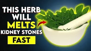 Kidney Stone Pain Relief Without Surgery? Try These Proven Natural Remedies