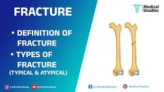 Bone fractures | Definition & Types of Fracture | Medical studies | @medicalstudiesaj