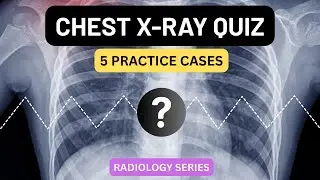Chest X-ray Quiz | 5 Practice CXR Cases with Explanations