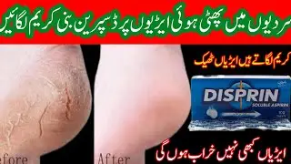 Hands feet repair cream | DIY hand & feet bleach | Hand whitening | Cracked Heels Repair Overnight