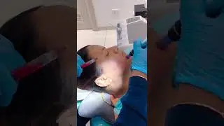 Bye Acne Marks & Fine Lines! PRP Glow Facial at UNO Unisex Salon 🌟  #punesalon#glowingskin