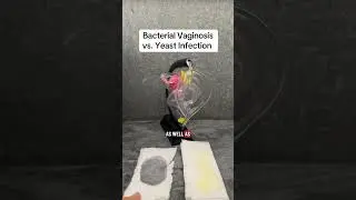Itching, burning, pain and discomfort can be symptoms of bacterial vaginosis AND yeast infections