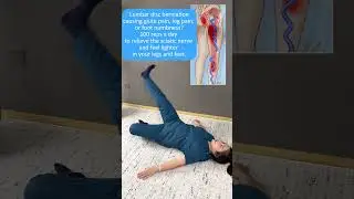 Suffering from Sciatic Pain? One Simple Exercise a Day Can Make Your Legs Feel Light Again!
